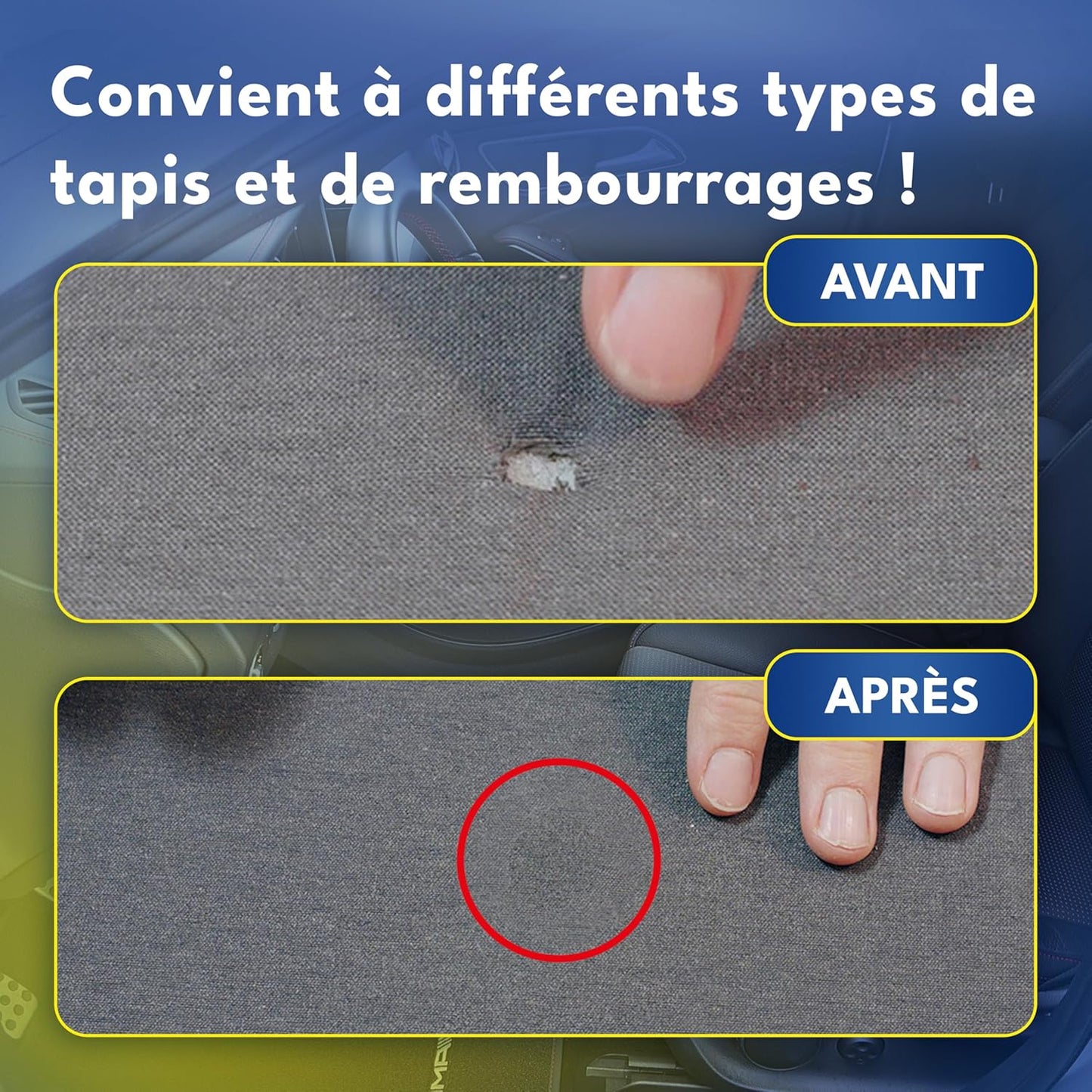 ULTRA KIT - Kit de réparation Siège et plafonnier